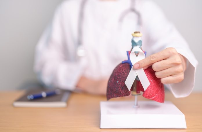 Cáncer de pulmón en Chile